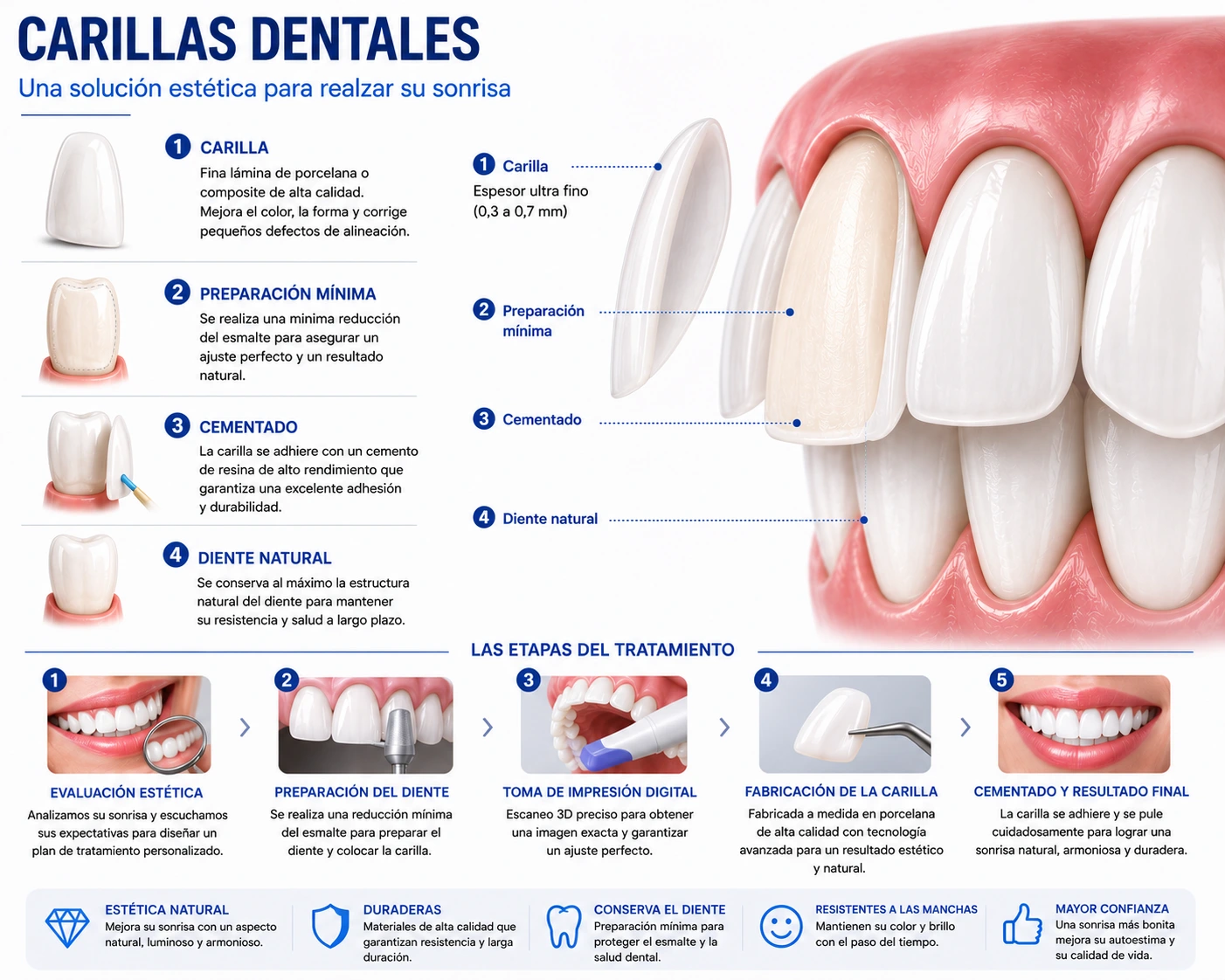 Carillas dentales