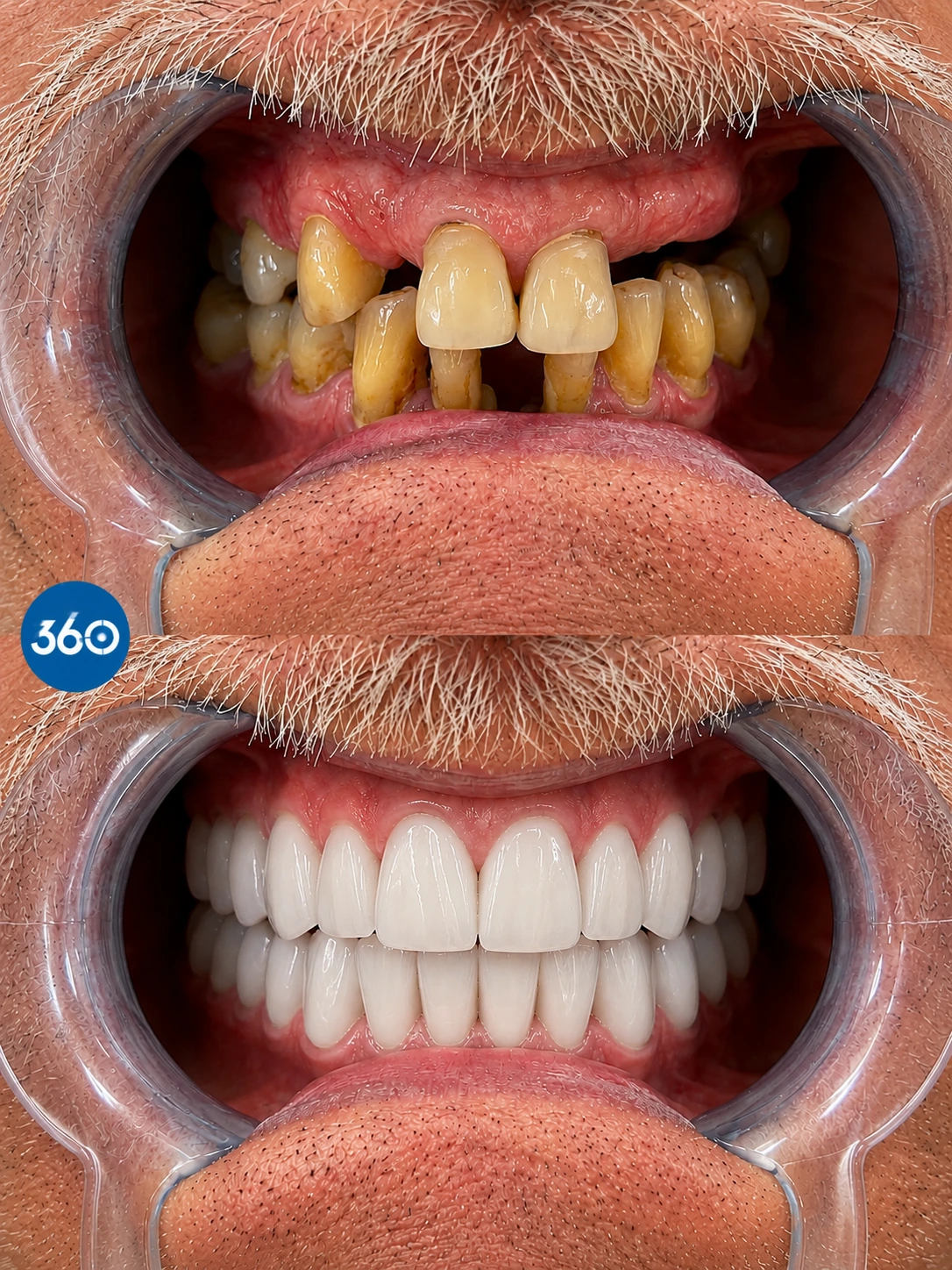 Sourires - 4
